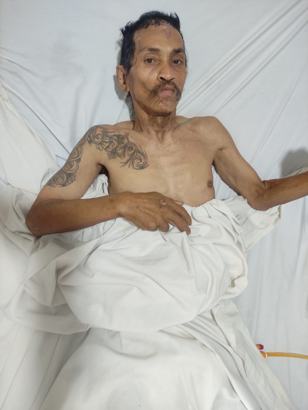 RS Adam Malik Rawat Pasien Tanpa Identitas, Korban Kecelakaan Lalu Lintas