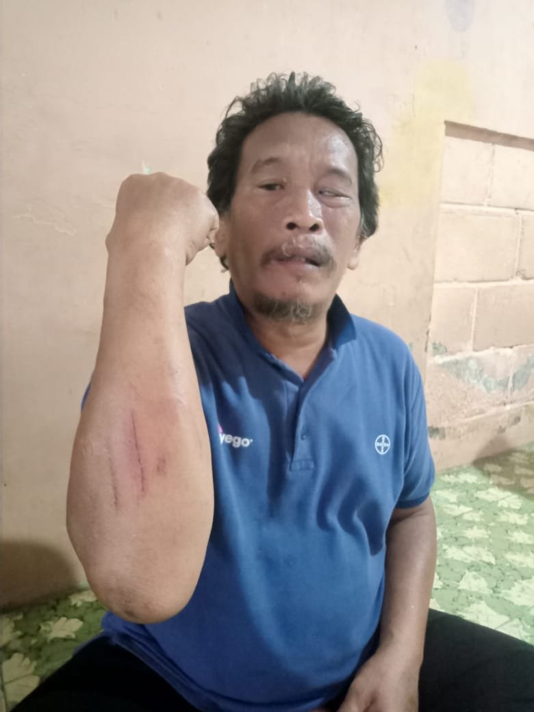 Naas, Pasutri Jatuh ke Parit, Sepeda Motor Dibawa Kabur