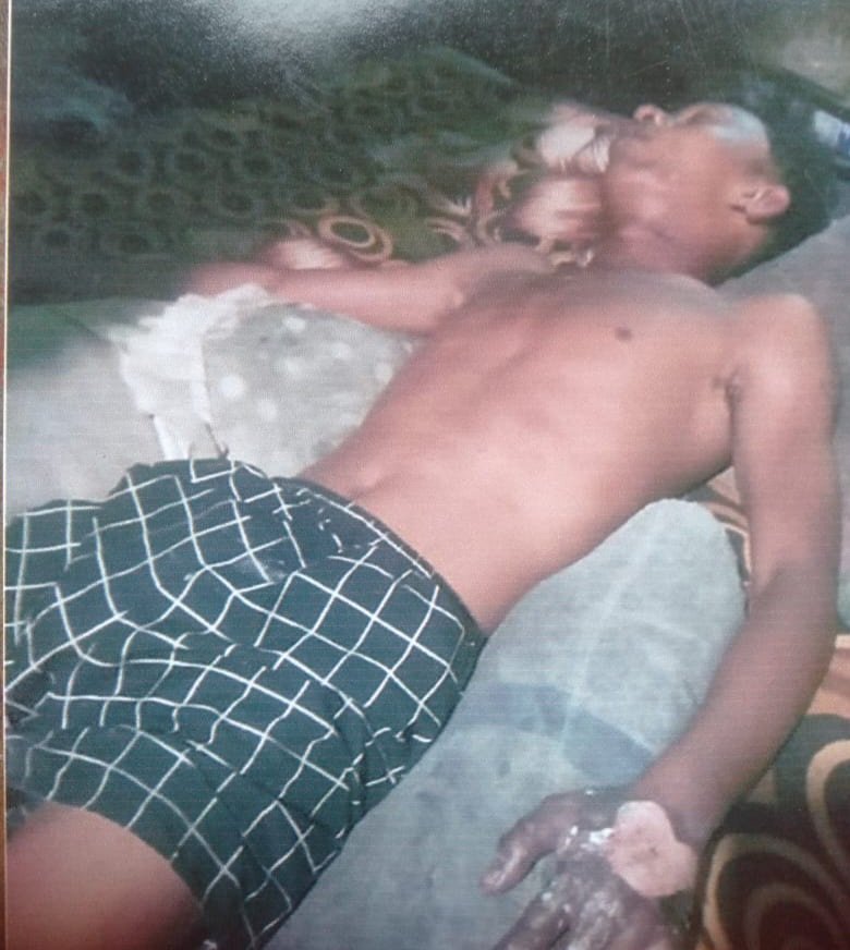 Gegara Ubi, Oknum Brimob dan ASN Diduga Tega Menganiaya dan Membakar 2 Pria