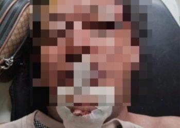 Polisi Masih Dalami Penyebab Tewasnya Wartawan Nico Saragih, Keluarga Tolak Otopsi