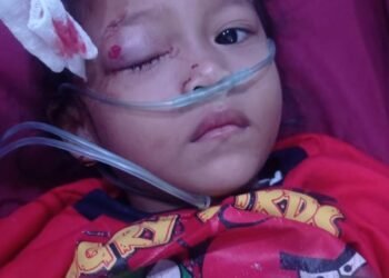 Anak 5 Tahun Jadi Korban Peluru Nyasar Saat Tawuran di Medan–Belawan