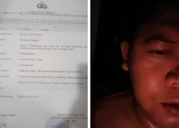 Dituduh dan Dikeroyok hingga Babak Belur, Ardhil Lapor ke Polsek Padang Tualang