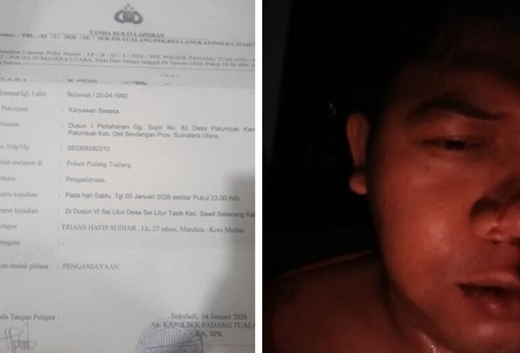 Dituduh dan Dikeroyok hingga Babak Belur, Ardhil Lapor ke Polsek Padang Tualang