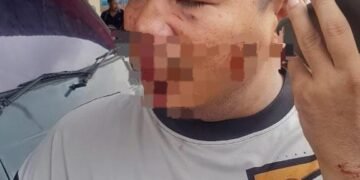 Diduga Tanpa Pemicu, Warga Patumbak Alami Penganiayaan Gunakan Helm