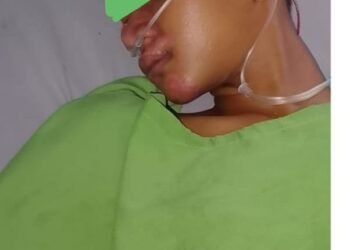 Dua Tahun, Pembacok Pelajar Belum Tertangkap, Orangtua Korban Desak Polresta D.Serdang Tangkap Pelaku