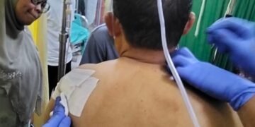Anggota DPRD Madina Binsar Nasution Ditikam Saat Melayat